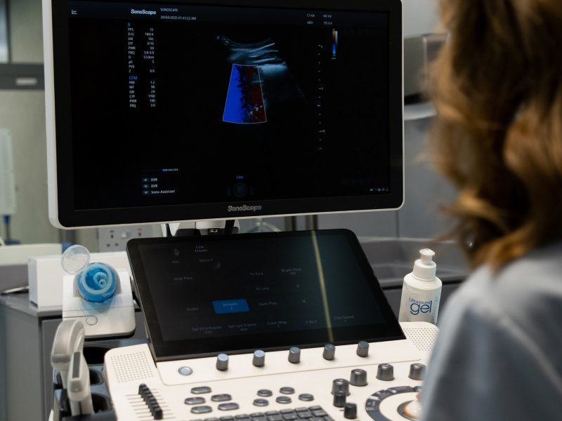 УЗИ сонных артерий. Почему важно пройти обследование — особенно в ритме Дубая